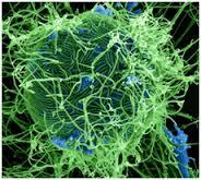 The Ebola crisis and its politics Courtesy of waterandhealth.org