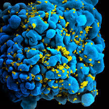 HHS open to HIV-1 vaccine development applications Courtesy of sciencedaily.com