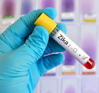 There are no vaccines or treatments available for Zika. File photo